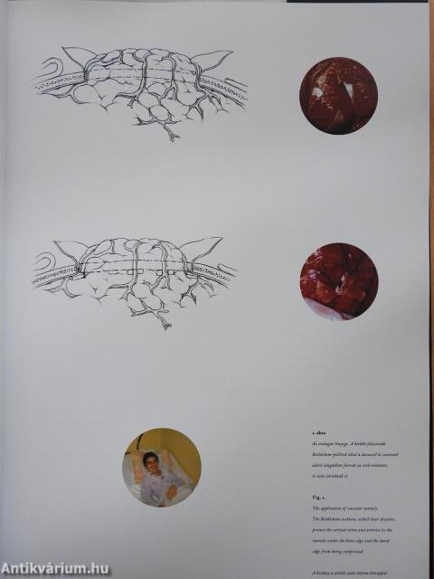 Művészet és idegsebészet együtt a hitben (dedikált példány)