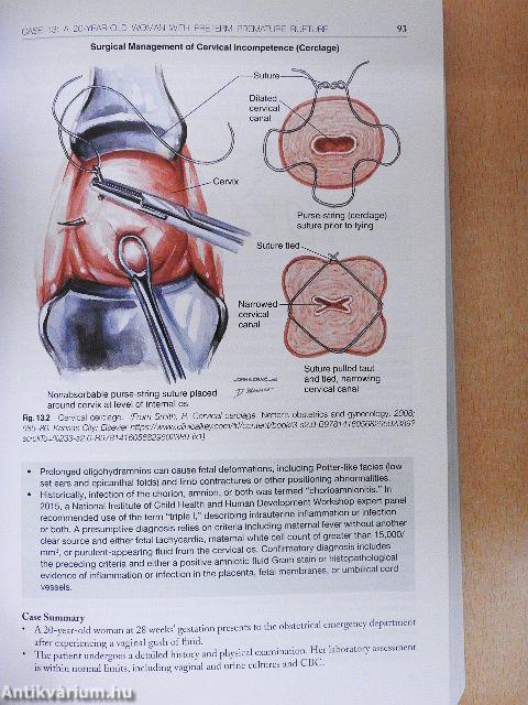 Obstetrics & Gynecology Morning Report