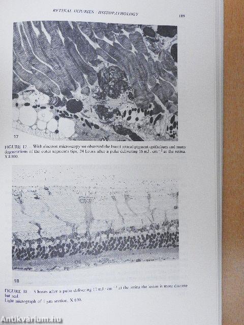 First International Symposium on Laser Biological Effects and Exposure Limits/Lasers et Normes de Protection