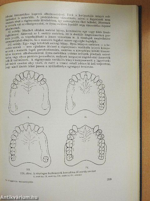 A fogpótlás technológiája