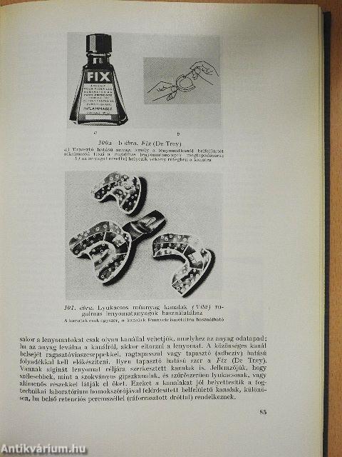 A fogpótlás technológiája