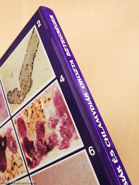 Rickettsiák és chlamydiák okozta betegségek