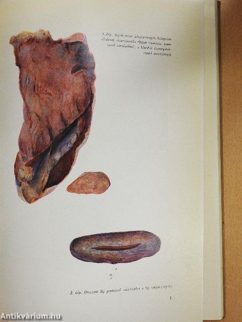 Húsvizsgálat és húshigiéne