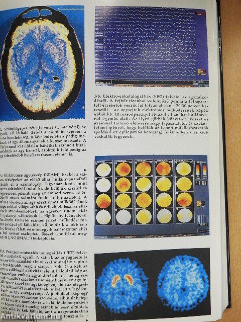 Az agy évtizedében