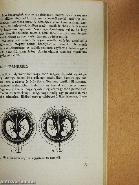 Szülőszoba, tessék belépni!