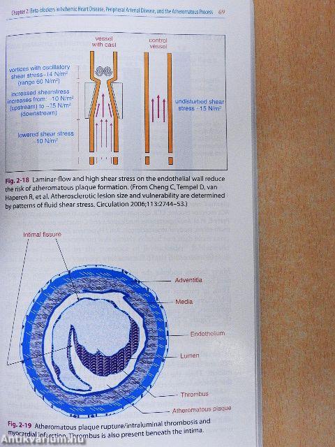 The Modern Role of Beta-Blockers in Cardiovascular Medicine