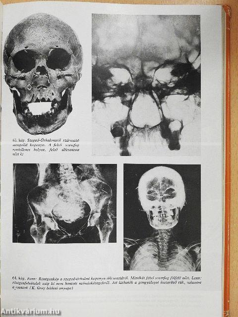 Sírok, csontok, emberek