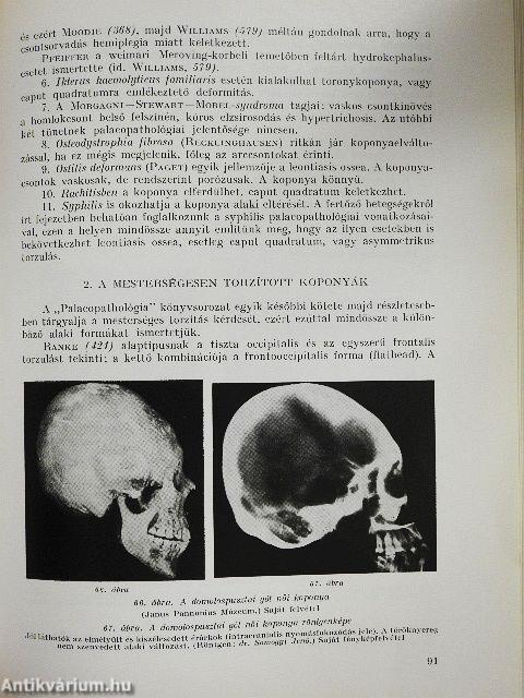 Palaeopathologia II.
