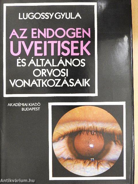 Az endogen uveitisek és általános orvosi vonatkozásaik