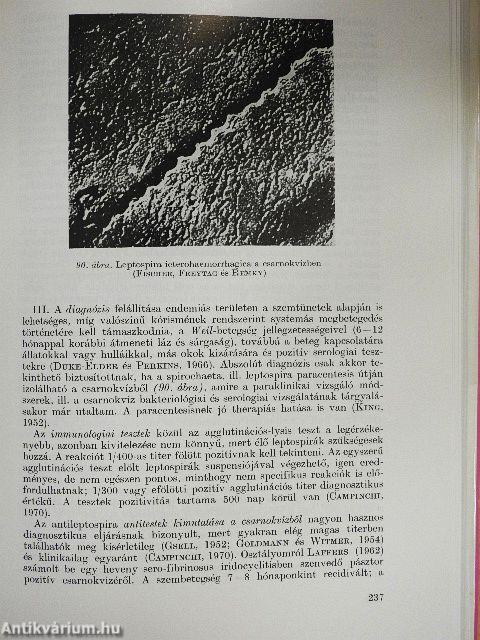 Az endogen uveitisek és általános orvosi vonatkozásaik