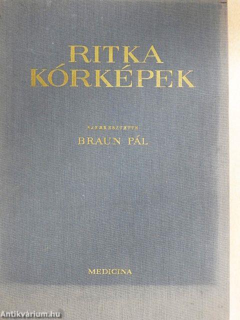 Ritka kórképek