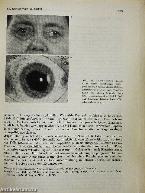 Innere Erkrankungen und Auge