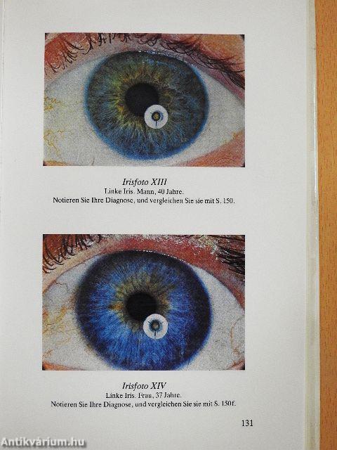 Die Kunst der Irisdiagnose