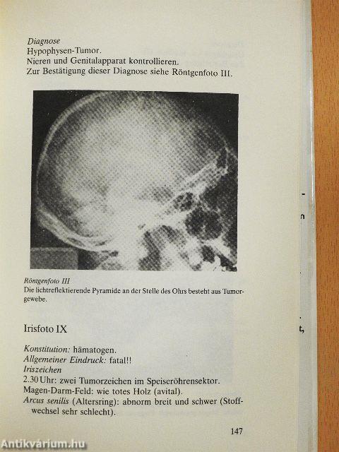 Die Kunst der Irisdiagnose
