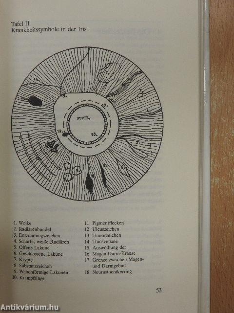 Die Kunst der Irisdiagnose