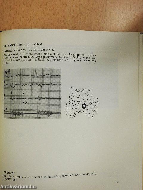 Hallgatódzás a szív felett I-II. - 6 db hanglemezzel