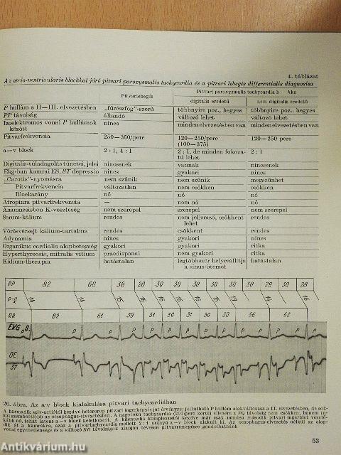 Hallgatódzás a szív felett I-II. - 6 db hanglemezzel