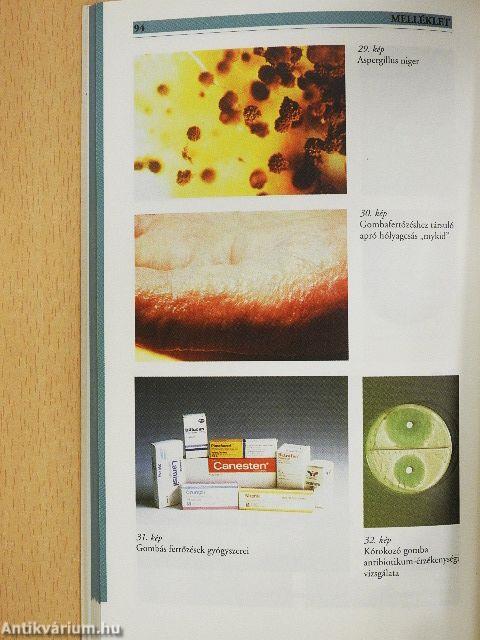 Gombás megbetegedések