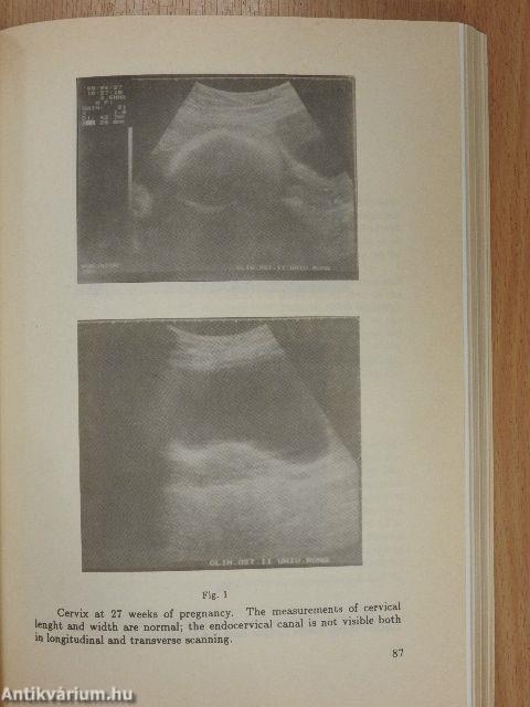 Recent Progress in Perinatal Medicine VI.