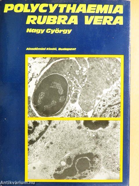 Polycythaemia rubra vera klinikuma, pathologiája és korszerű kezelése