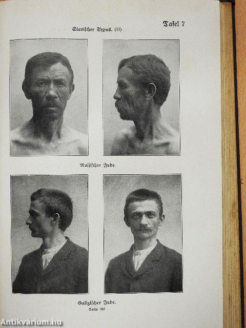 Die Rassenmerkmale der Juden