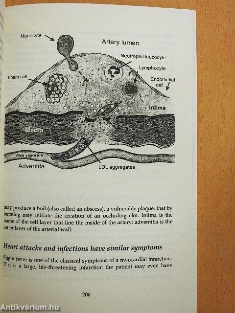 Fat and Cholesterol are GOOD for You!