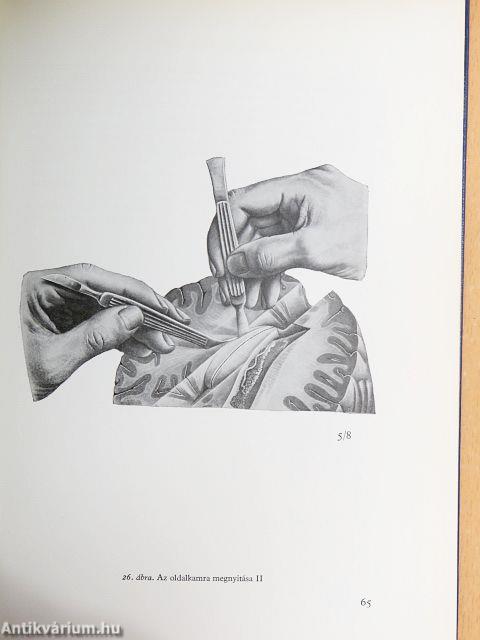 Az agyvelő boncolása