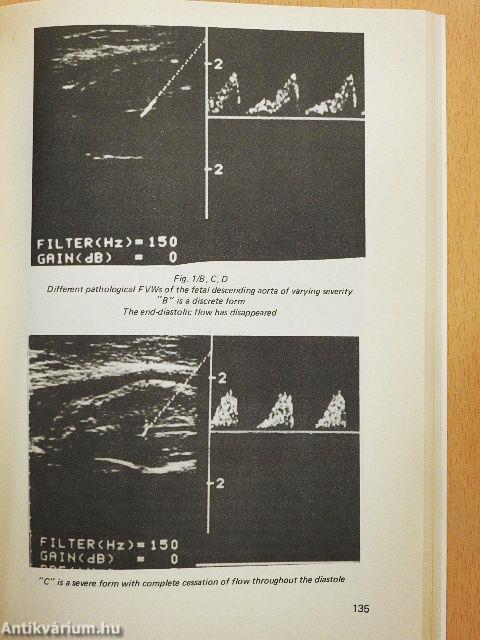 Recent Progress in Perinatal Medicine V.