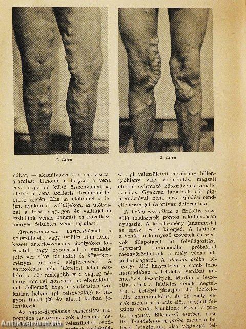 Egészségügyi munka 1979. április