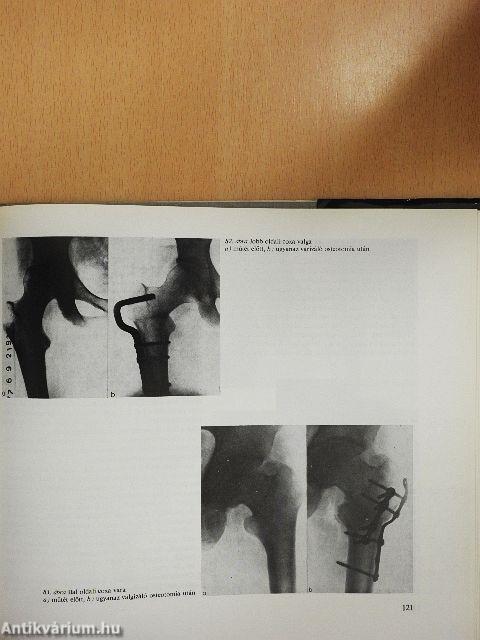 Az ortopédia tankönyve