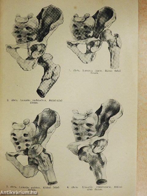 A traumatológia alapelemei VI.