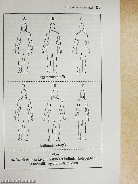 Farkaséhség (bulimia)