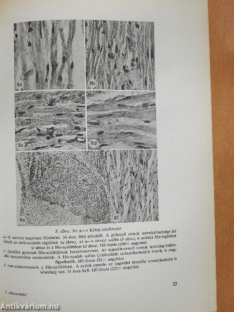 Myocardialis infarctus