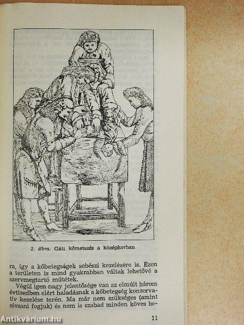 Vesekőről veseköveseknek