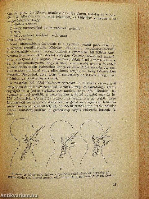 A gyomor betegségei