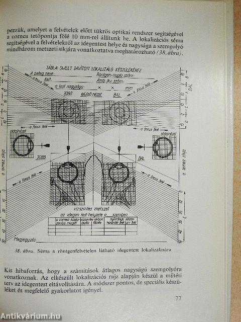 Szembetegek vizsgálata