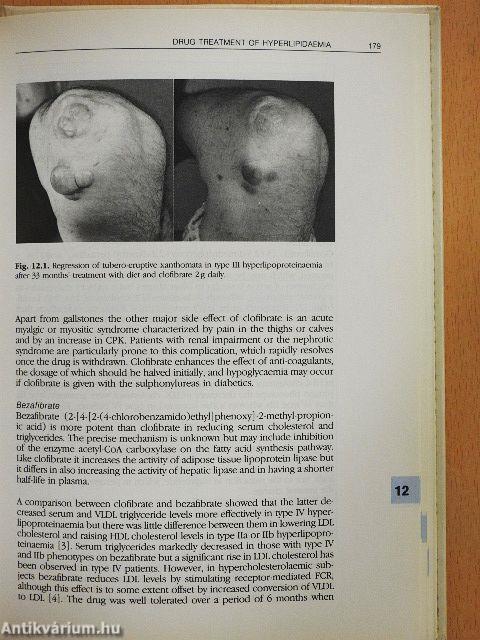 A Handbook of Hyperlipidaemia