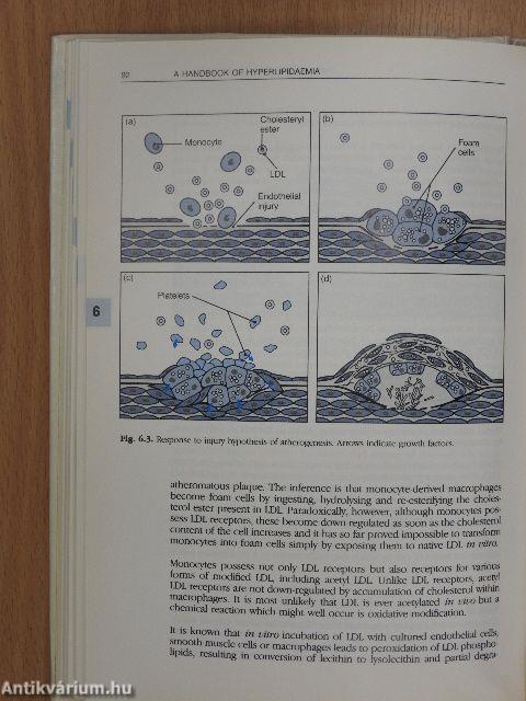 A Handbook of Hyperlipidaemia