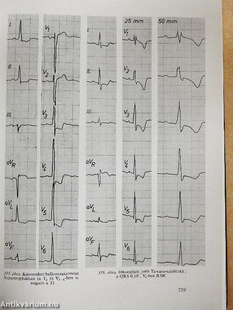 Belbetegségek elkülönítő diagnózisa I-II.