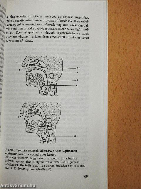 Légzészavarok alvás alatt