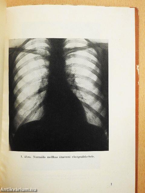 Röntgenkép, röntgenlelet