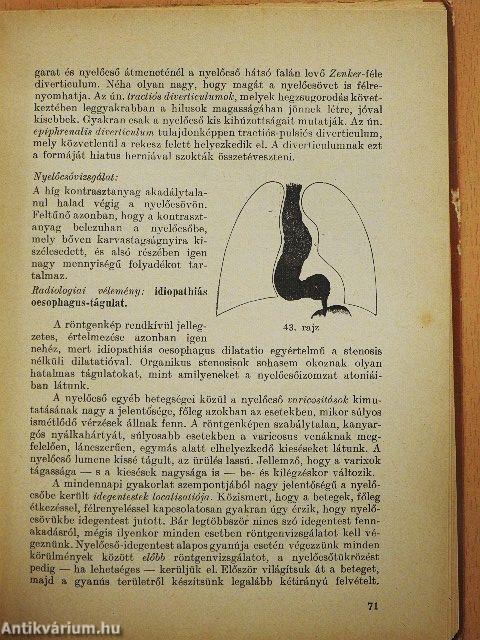 Röntgenkép, röntgenlelet