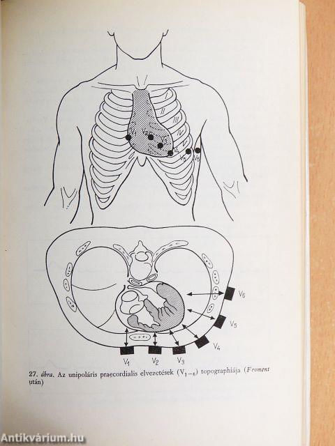 Electrocardiographia az orvosi gyakorlatban