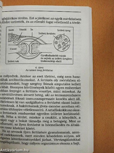 Hogyan orvosoljuk reumánkat és ízületi fájdalmainkat