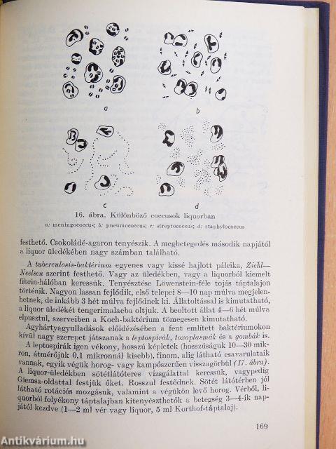 Gyakorlati liquor-diagnosztika