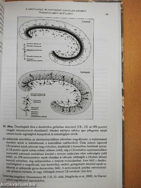 Hippocampus mint neuropszichiátriai betegségek közös nevezője