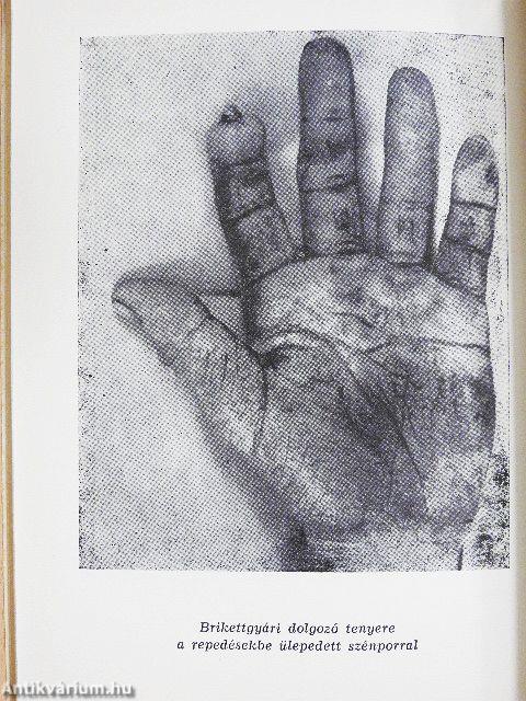 Foglalkozási eredetű ipari bőrbetegségek