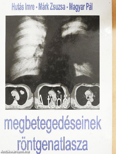 A tüdő megbetegedéseinek röntgenatlasza