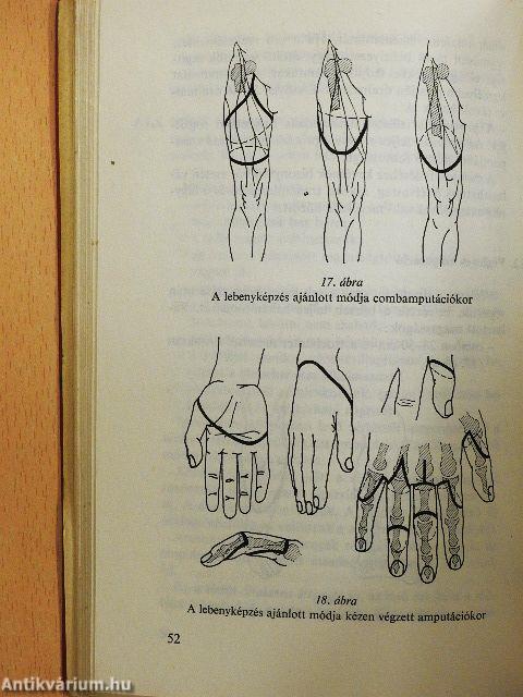 Sérültek ellátása háborúban és békében