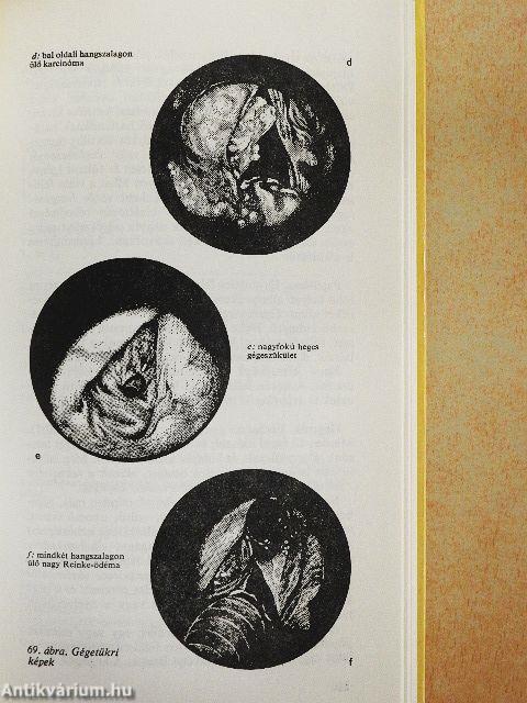 A gyakorló orvos fül-orr-gégészete
